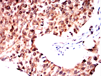 TRIM63 Antibody