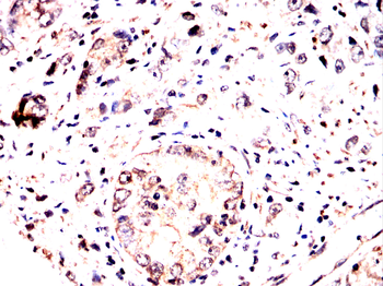 CAV2 Antibody