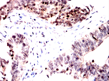 CAV2 Antibody