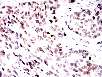CAV2 Antibody