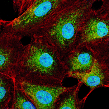 MEN1 Antibody