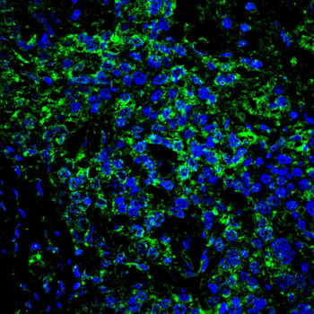 RAB27A Antibody