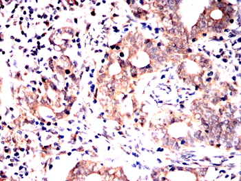 RAB27A Antibody