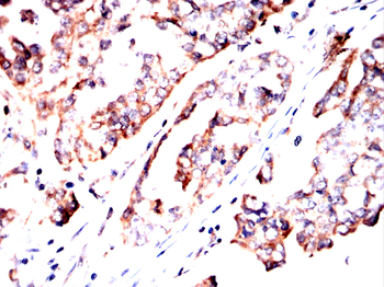 RAB27A Antibody