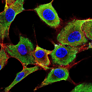 PRKACA Antibody