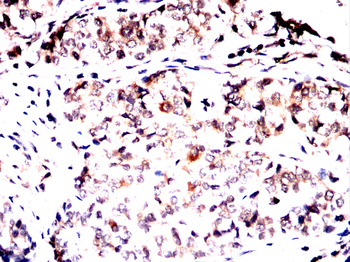 PRKACA Antibody