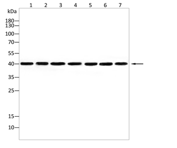 PRKACA Antibody