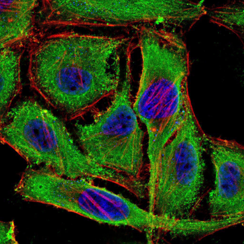 PRKACA Antibody