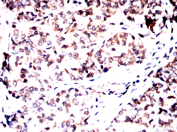 PRKACA Antibody