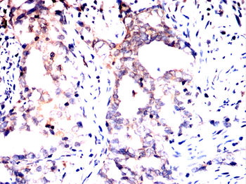 PRKACA Antibody