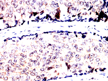 PRKACA Antibody