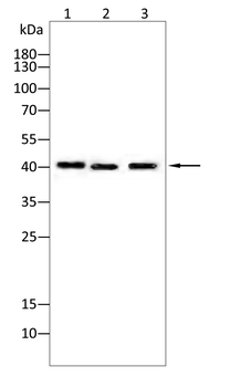PRKACA Antibody