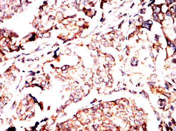 RANGAP1 Antibody
