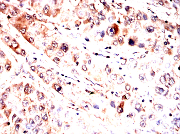 RANGAP1 Antibody