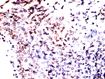 RANGAP1 Antibody