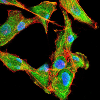 RPS6KA2 Antibody