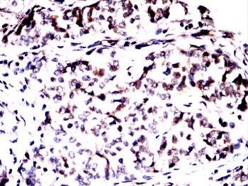 RPS6KA2 Antibody