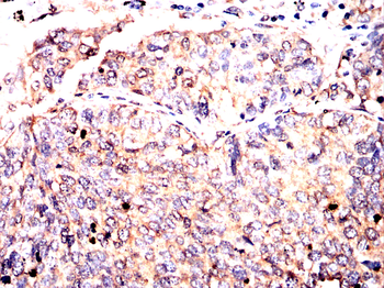 RPS6KA2 Antibody