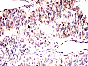 RPS6KA2 Antibody
