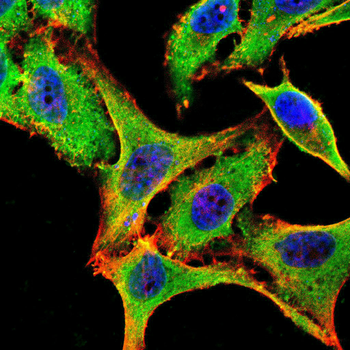 RPS6KA2 Antibody