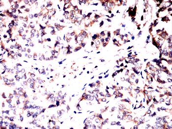 RPS6KA2 Antibody