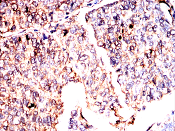 RPS6KA2 Antibody