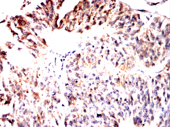 RPS6KA2 Antibody