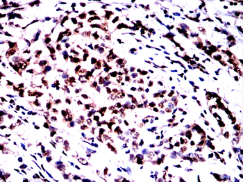 HSF1 Antibody