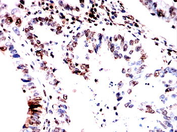 HSF1 Antibody