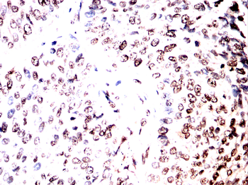 HSF1 Antibody