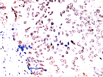HSF1 Antibody