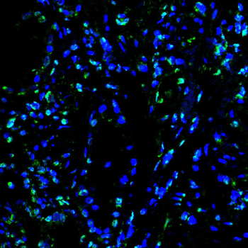 HSF1 Antibody