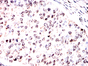 HSF1 Antibody