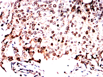 HSF1 Antibody