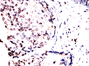 HSF1 Antibody