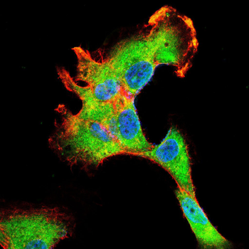 RAP1GAP Antibody
