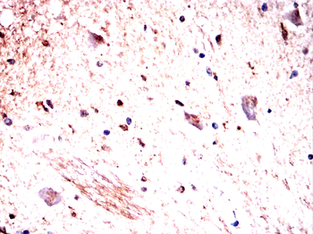 RAP1GAP Antibody