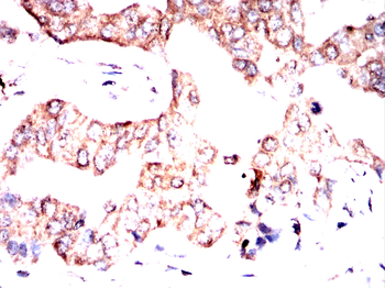 RAP1GAP Antibody