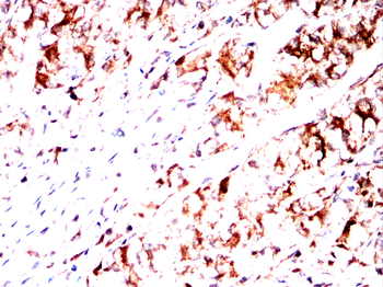 RAP1GAP Antibody