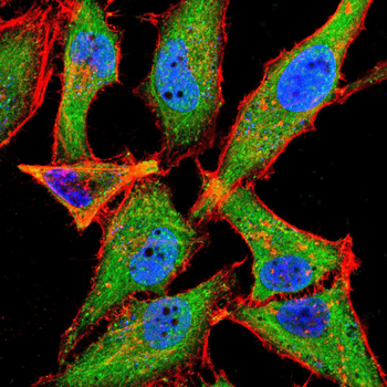 RAP1GAP Antibody