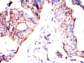 RAP1GAP Antibody