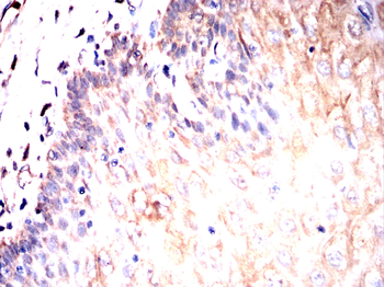 RAP1GAP Antibody