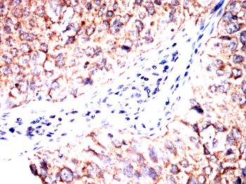RAP1GAP Antibody