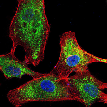 SERPINA3 Antibody