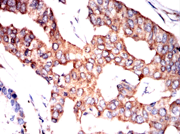SERPINA3 Antibody