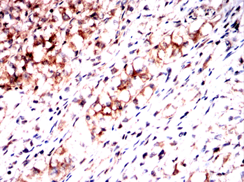 SERPINA3 Antibody