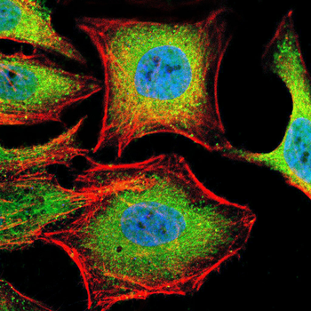 SERPINA3 Antibody
