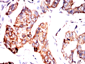 SERPINA3 Antibody