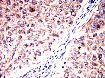 SERPINA3 Antibody
