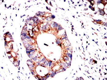 SERPINA3 Antibody